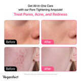 Pore Refining Fig Chestnut Ampoule