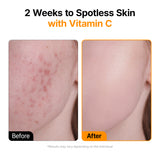 Radiant Glow KAKADU Vita C Mix Ampoule