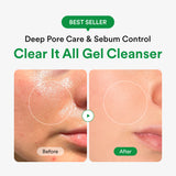 [Amazon #1] Korean Superfood Gel Cleanser