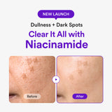 [Amazon] NMN Collagen Serum