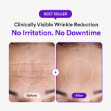 [Amazon] NMN Collagen Serum Valentine’s Day Deal