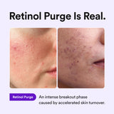 [Amazon] NMN Collagen Serum Valentine’s Day Deal